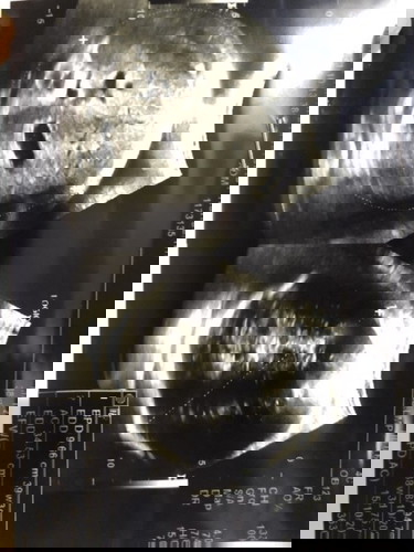 Bun, janin besar dan ketuban banyak di 38w, nih.