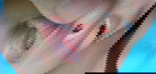 Lidah putih pada bayi