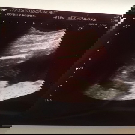 ทายเพศกันค่ะ☺️