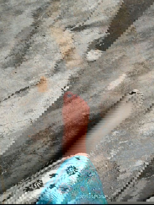 Hamil 37 minggu kaki uda bengkak kayak gini?? Normal nggak sih bun??????????? Mohonpencerahannya🙏🙏