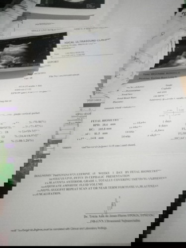 Paninigas ng tyan apat na buwan normal lng po ba