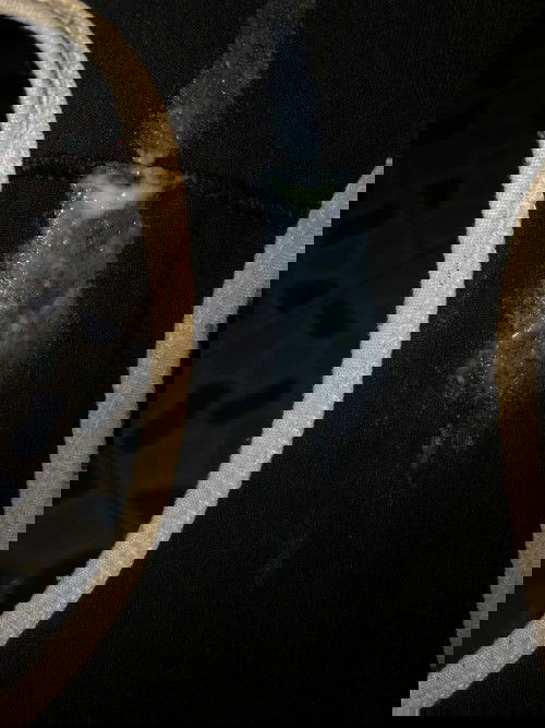 แบบนี้ควรไปโรงบาลเลยไหมคะหรือรอให้น้ำเดินก่อน