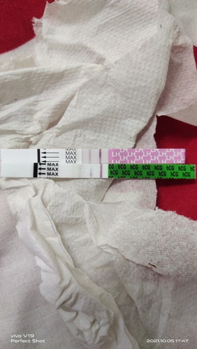 Betul ke opk dan upt tak bole letak sebelah²? Upt sy tu jd separuh mcm tu..-v ke +v ye mcm tu😥