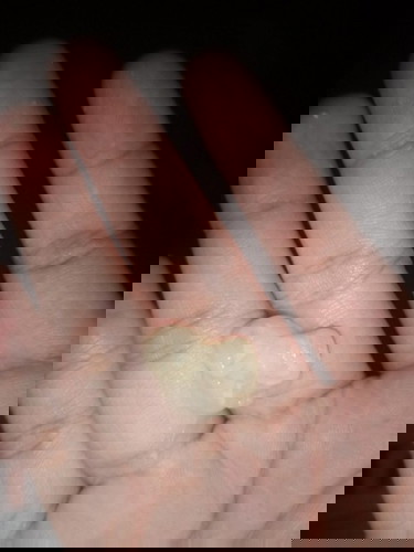 แบบนี้เรียกตกขาวใช่ไหมค่ะ