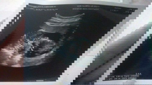 Belum ngerasain kedutan setiap hari