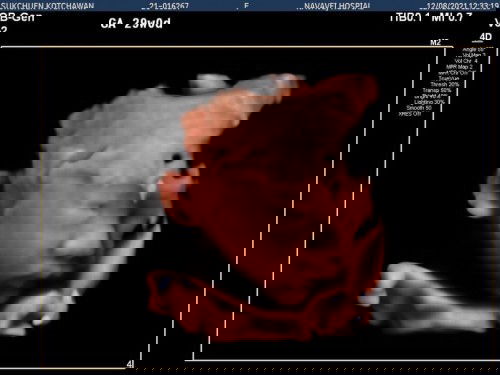 #ทีมเดือนตุลาคม
#ประสบการณ์ท้องลูกคนแรก🤭👶🏻