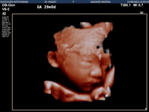 #ทีมเดือนตุลาคม
#ประสบการณ์ท้องลูกคนแรก🤭👶🏻