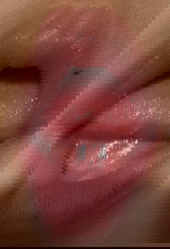 Teethinggg