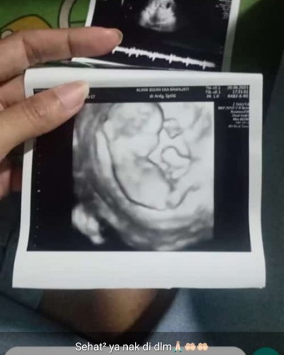 Hamilku kecil dan sudah berusia 28minggu kenapa