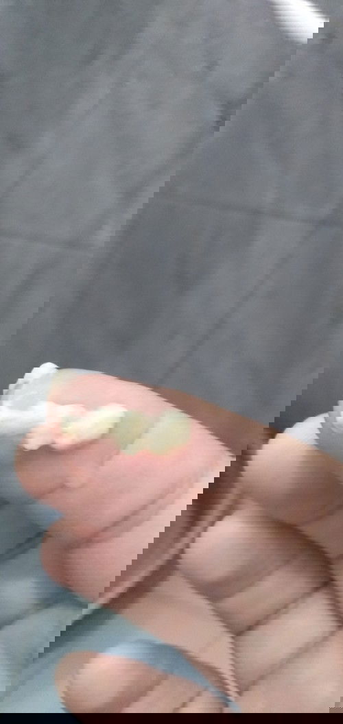 Keputihan 36 week ( maaf jorok )