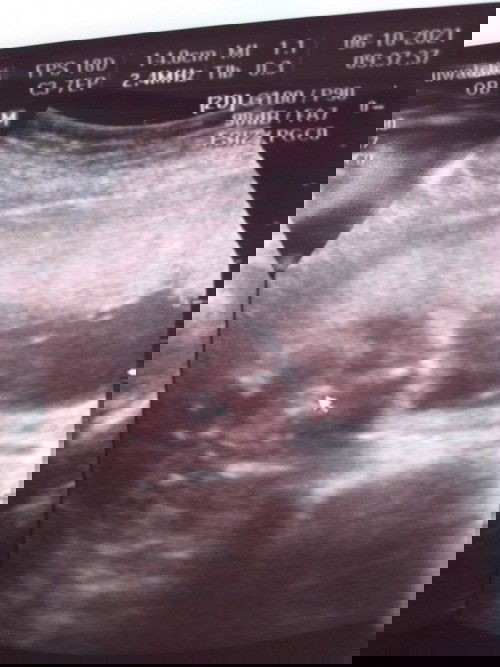 อยากรู้ว่าผู้หญิงหรือผู้ชายค่ะ