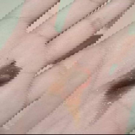 34 weeks na po ako ngaun at my lumabas skin po kahapon pure white..pro ngaun ganyan n po.. Plz help