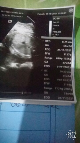 Bingung yg mn yg bnr