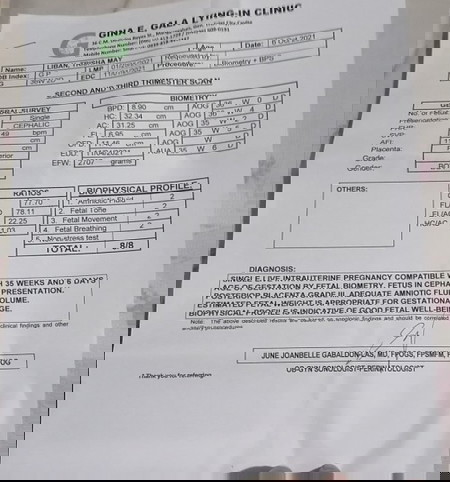 ano po bang ibig sabihin ng resulta