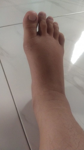 Kaki bengkak di usia kehamilan 38week