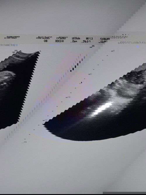 มีเเม่ๆคนใหนพอดูออกกันใหมคะว่าน้องเพศอะไร