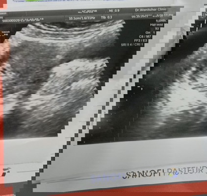 ท้อง 1 เดือนคะ