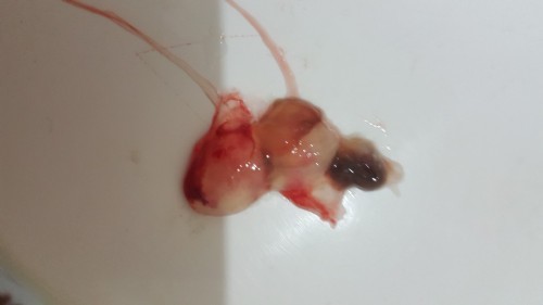 MANGANGANAK NA PO BA?