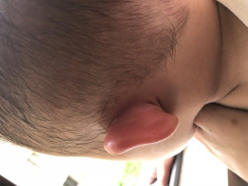 NAMUMULANG TENGA NI BABY