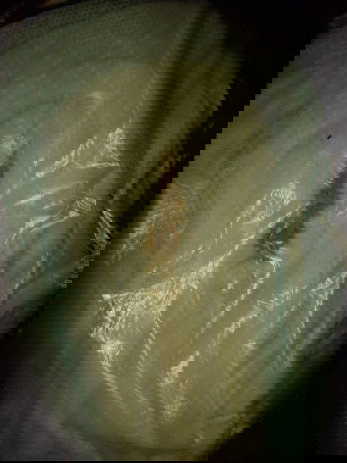 ประจำเดือนมา12สิงหาหายไป1เดือน25วันมาวันที6ตุลาเหมือนในรูปพอจะเป็นเลือดล้างหน้าเด็กได้ไม่ค่ะ