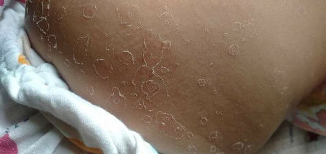 ทารก3เดือน