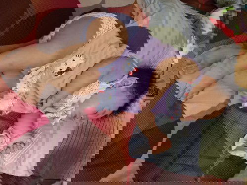 Noda hitam dikulit bayi