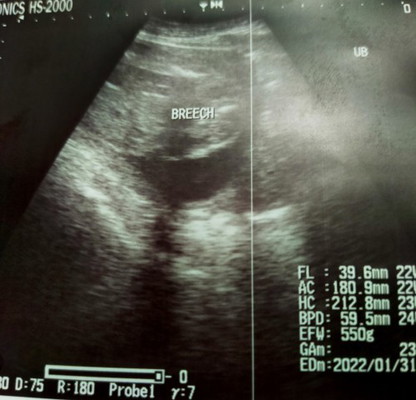 MY BABY 🥰🥰🥰