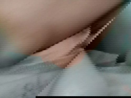 น้องสะดือ จุ่น พองมาก น้องไม่ถ่ายมา3วันอันตรายไหมค่ะ