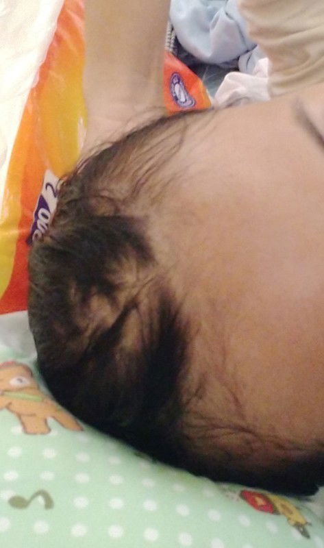 Rambut rontok setelah melahirkan