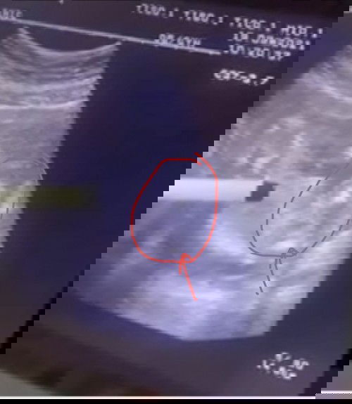 ช่วยดูหน่อยคะ ผู้หญิง หรือ ชาย🥰