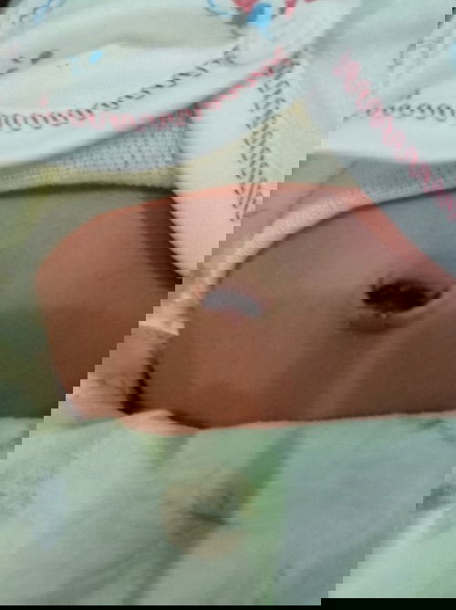 Perawatan pusar yang sudah puput