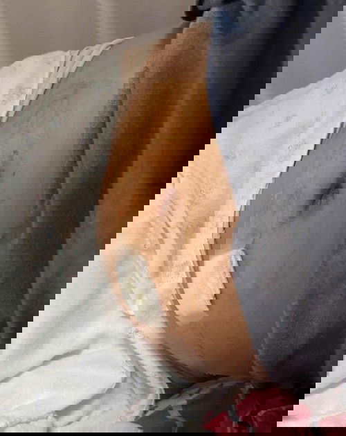 ประสบการณ์เจาะน้ำคร่ำ