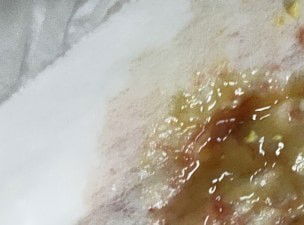 แม่ๆค่สอบถามหน่อยค่ะ
พอดีว่าวันนี้ลูกถ่าย 4 รอบแต่ปนเลือดออกมา 2 รอบ
ร่าเริงกินนมได้ปกติเปนไรไหมค่