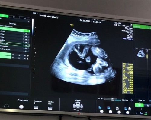 ทายเพศให้หน่อยค่ะแม่ๆ