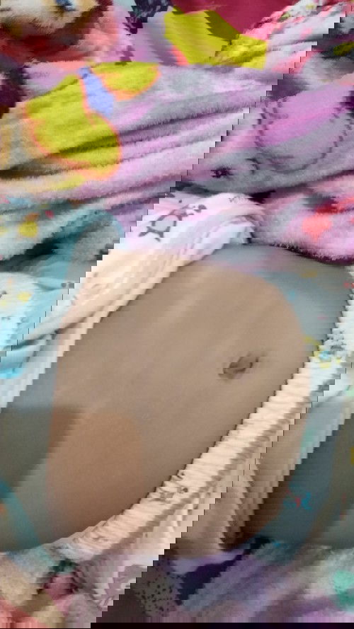 Seperti panu diperut bayi