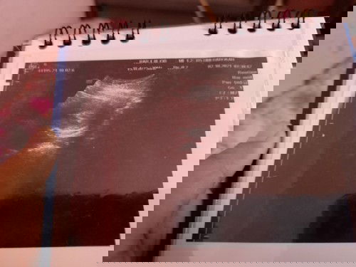 Belum terlihat kantung janin