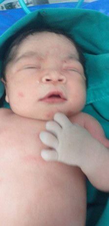 คลอดแล้วค่ะ แอบอยู่ในกลุ่มอยู่นาน😍😍