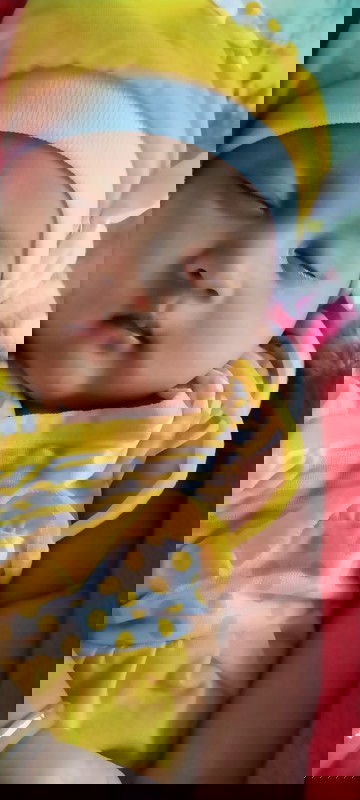 Bayi umur 2 bulan diare