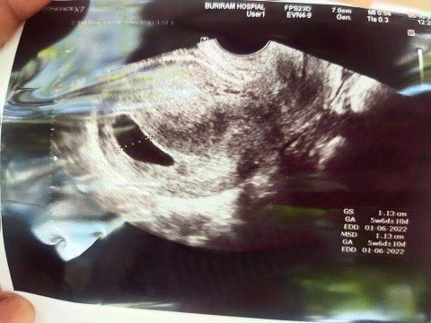 อย่าพึ่งเลื่อนผ่านกันนะคะ
ขอบคุณจ้า