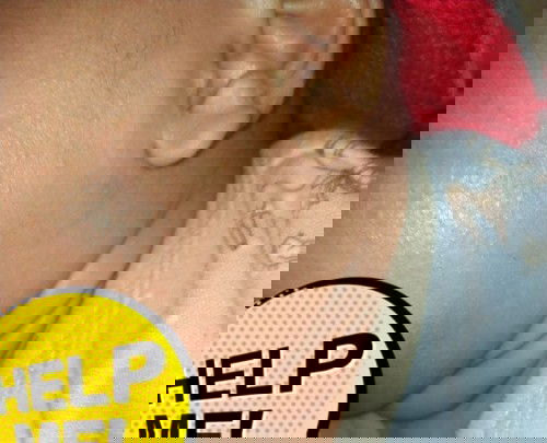 Ruam merah dan bintik merah di kepala dan wajah bayi umur 2 bulan  minta saran cream