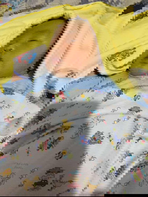 Bayi ku iritasi dipantat