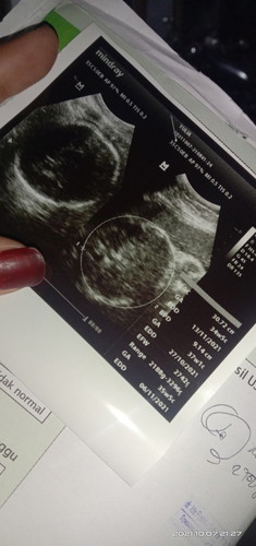 Menyesal pindah bidan