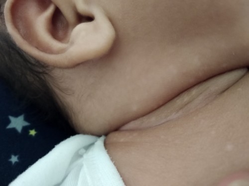 Alam nyo ba kung ano tong nasa neck ni baby?