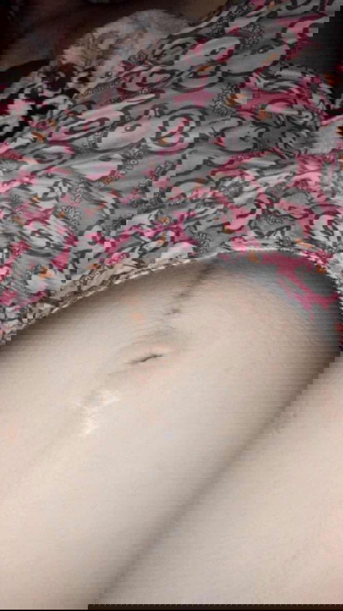 ล่าสุดท้องแม่ลายแล้วจ้า
35+2