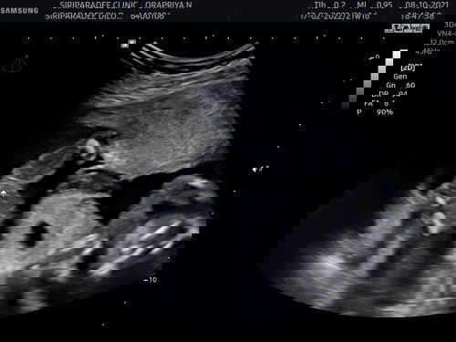 แม่ๆว่า ผช/ ผญ คะ คุณหมอบอก ผช