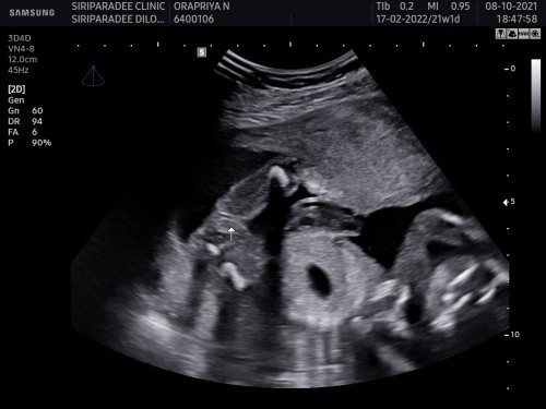 แม่ๆว่า ผช/ ผญ คะ คุณหมอบอก ผช