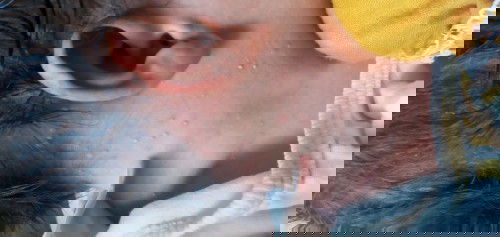 Bintik putih setelah lahir