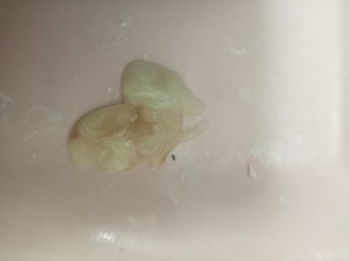 ano po ibigsabihin pag nilabasan ka ng parang sipon sa vigina? 38weeks napo ako.