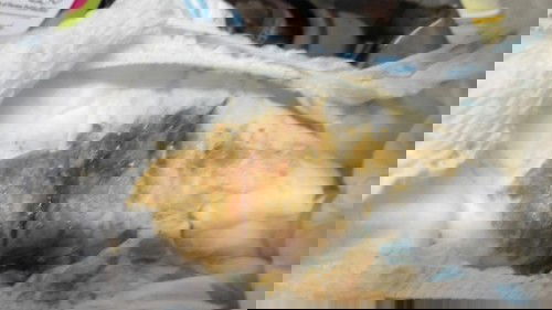 May dugo sa poops ni Baby