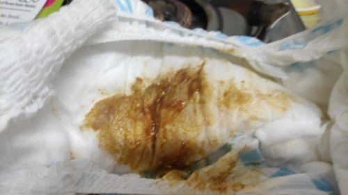 May dugo sa poops ni Baby